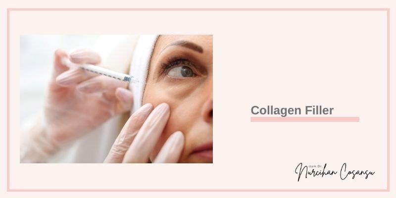 Collagen Fillers