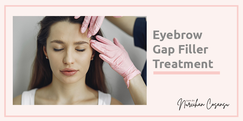 Eyebrow Gap Filler Treatment