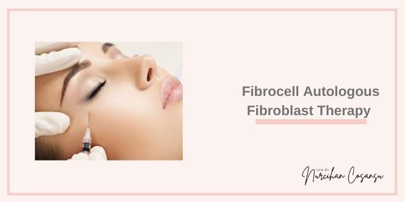 Fibrocell Autologous Fibroblast Treatment