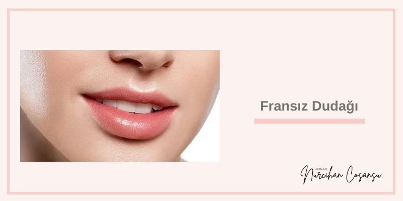 French Lip Aesthetics