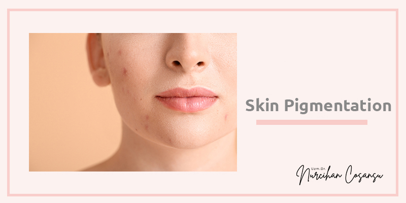 Skin Spots