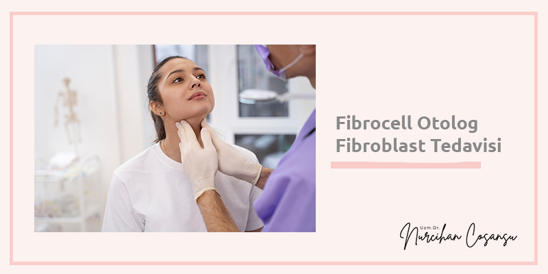 Fibrocell Otolog Fibroblast Tedavisi