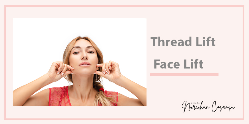 Thread Lift Face Lift