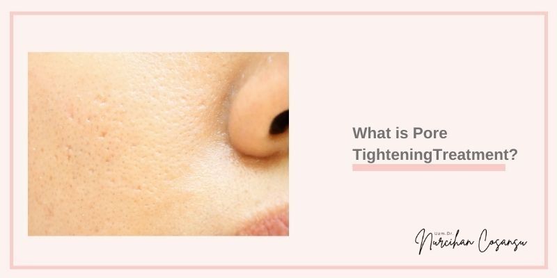 Pore Tightening Treatment