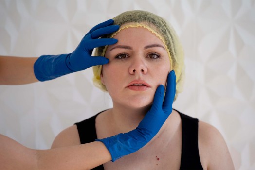 What You Need to Know About Non-Surgical Face Lifting
