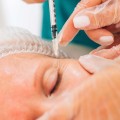 Botox ve Dolgu Arasındaki 6 Fark