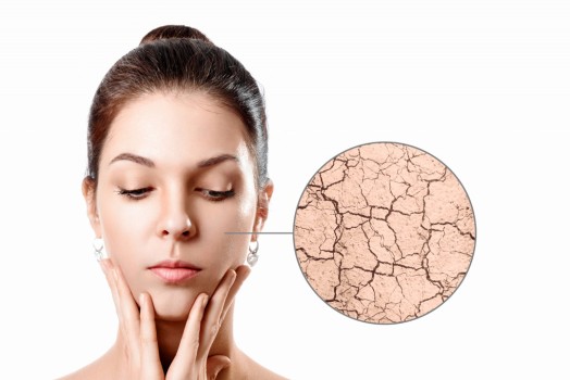 What Is Skin Dryness, Causes, and Prevention Methods