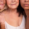How to Determine Skin Type and Its Features?