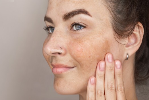Combined Methods for Uneven Skin Tone