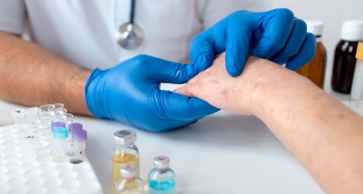Dermatolojik Tedavi Yöntemleri Nelerdir?