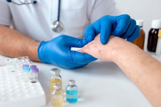 What Are the Dermatological Treatment Methods?