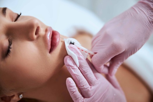 Lip Filler Aftercare Guide