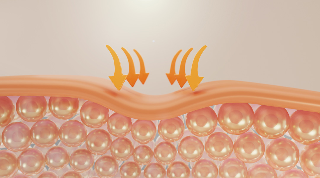 Epidermis Sağlığı Neden Önemlidir?
