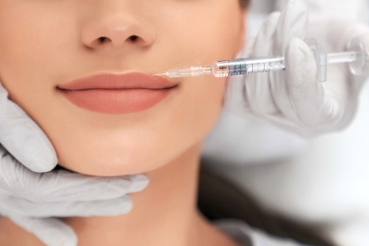 Differences Between French Lip Aesthetics and Russian Lip Filler