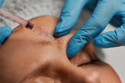 Hyaluronic Acid Injections: Its Role in the Skin and Effects on the Body