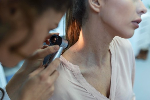 What Is Laser Mole Treatment, and How Is It Performed?