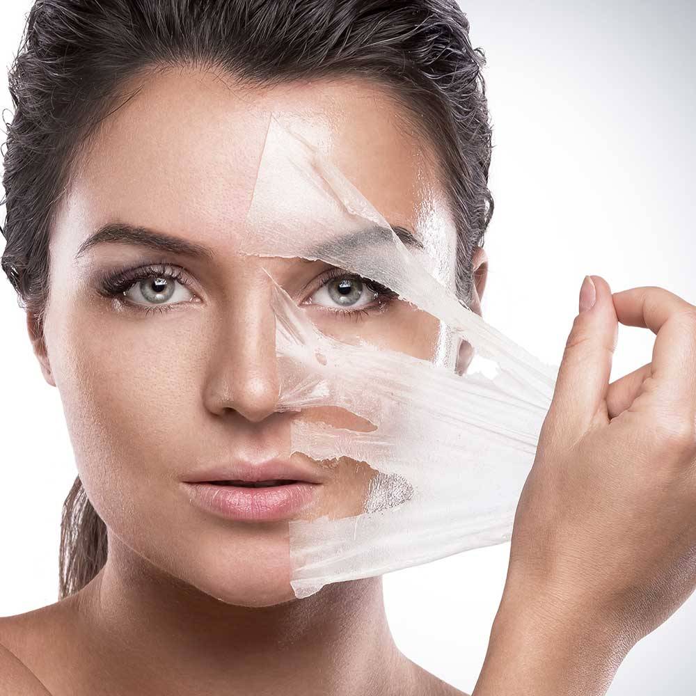 Peeling