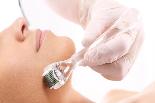 Roller and Dermapen