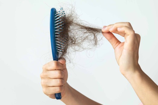 Hair Loss: Why It Happens and Solutions