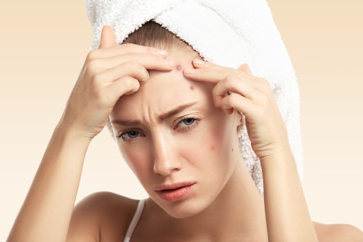 A Comprehensive Approach to Stress-Induced Acne Treatment